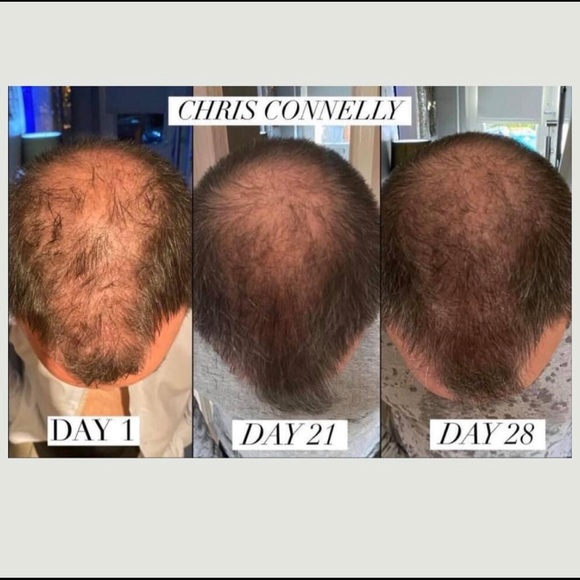 Multi-patented Liquid BioCell - Liquid Collagen https://modere.co/3CKXFAh - Picture 6 of 16